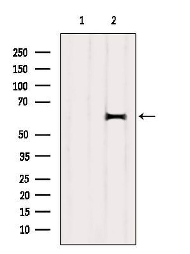 DOK1 Antibody in Western Blot (WB)