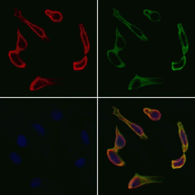 VEGFB Antibody in Immunocytochemistry (ICC/IF)