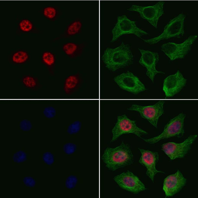 SF3B1 Antibody in Immunocytochemistry (ICC/IF)