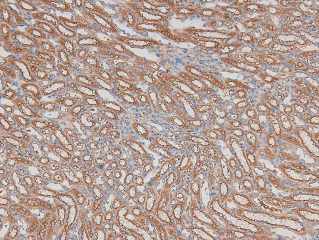 Phospho-ILK (Ser343) Antibody in Immunohistochemistry (Paraffin) (IHC (P))