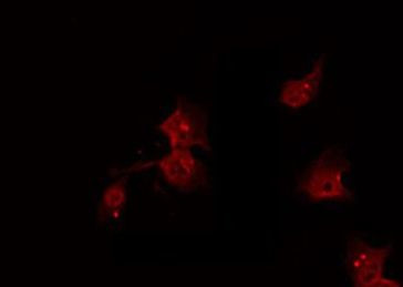 Phospho-PKC alpha (Ser657) Antibody in Immunocytochemistry (ICC/IF)