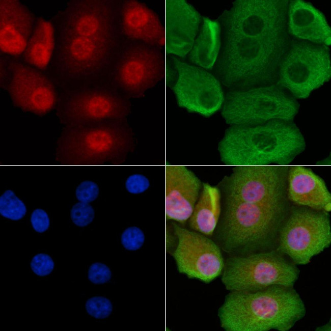 Phospho-PTRF (Tyr156) Antibody in Immunocytochemistry (ICC/IF)