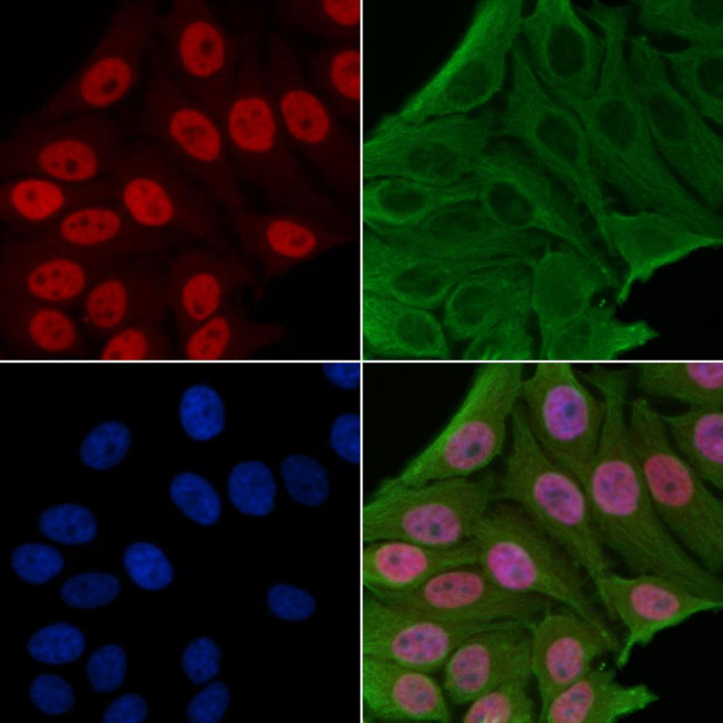 Phospho-TOPBP1 (Ser1159) Antibody in Immunocytochemistry (ICC/IF)