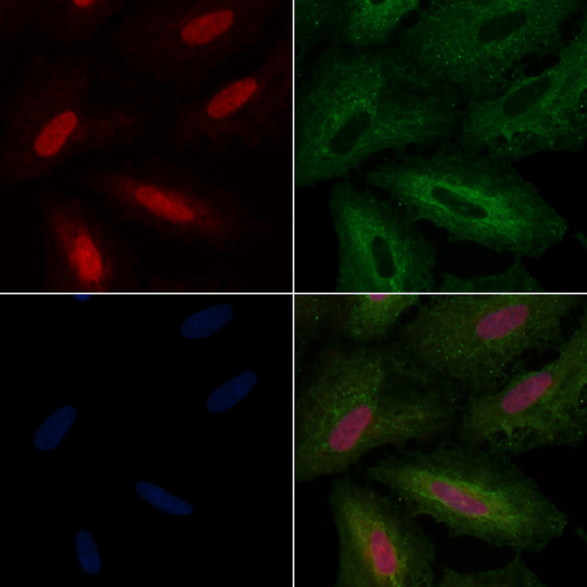 A20A3 Antibody in Immunocytochemistry (ICC/IF)