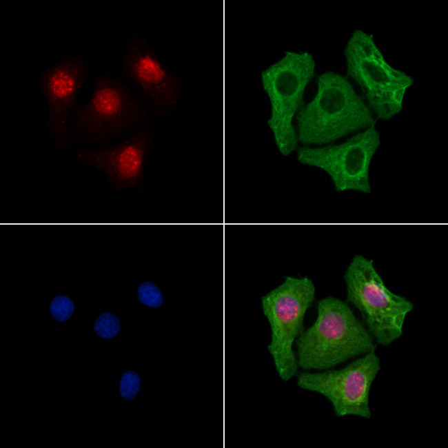 NR2F2 Antibody in Immunocytochemistry (ICC/IF)