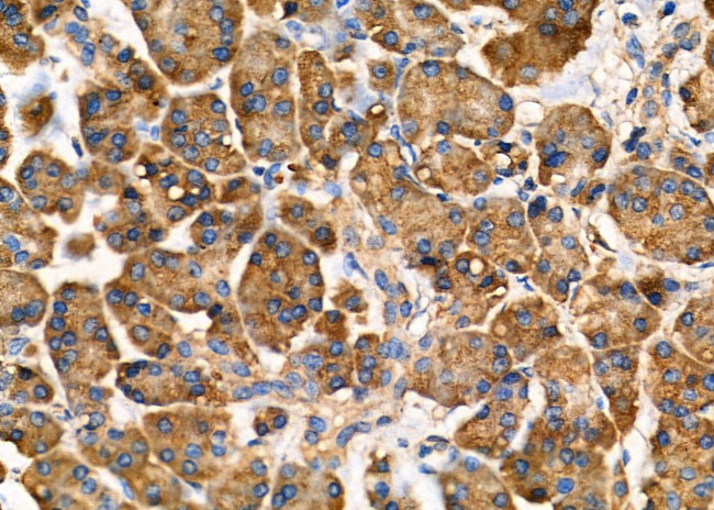 ARRDC1 Antibody in Immunohistochemistry (Paraffin) (IHC (P))