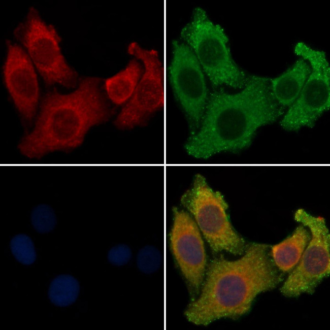 ARRDC2 Antibody in Immunocytochemistry (ICC/IF)