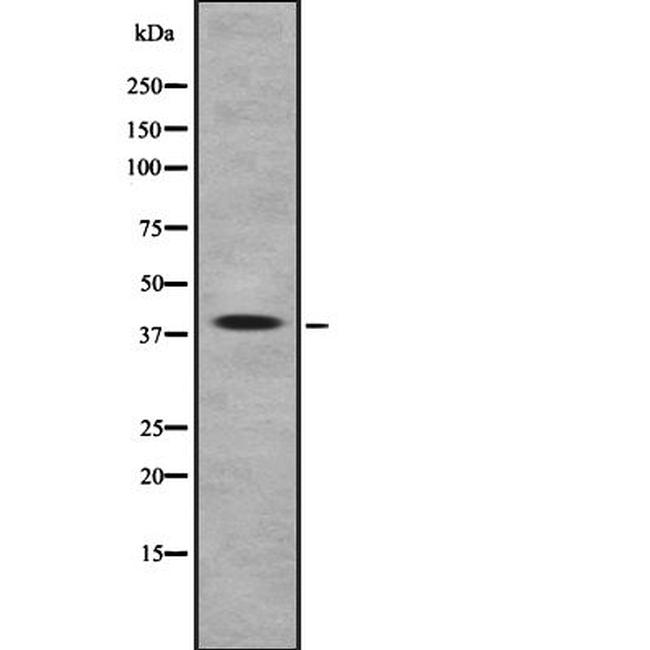 ARR3 Antibody in Western Blot (WB)