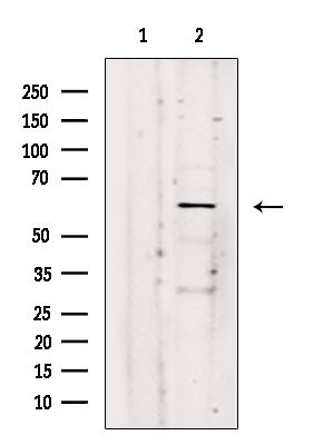 ARSK Antibody in Western Blot (WB)