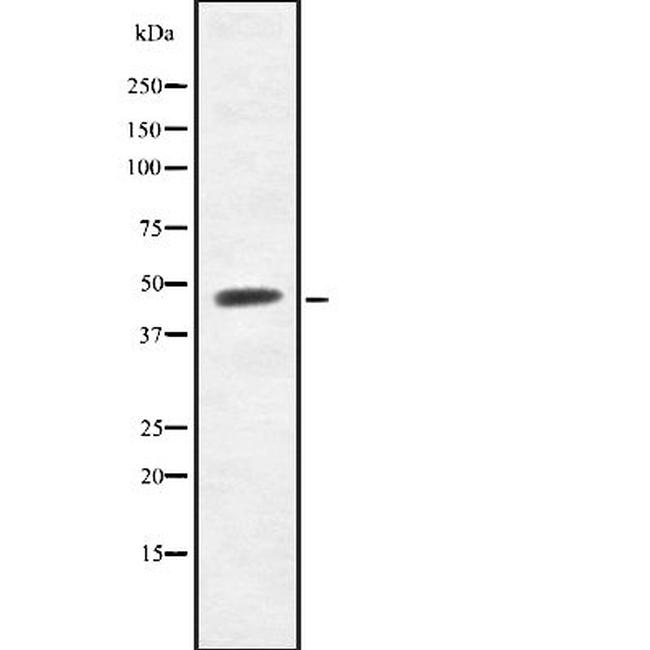 BTBD6 Antibody in Western Blot (WB)