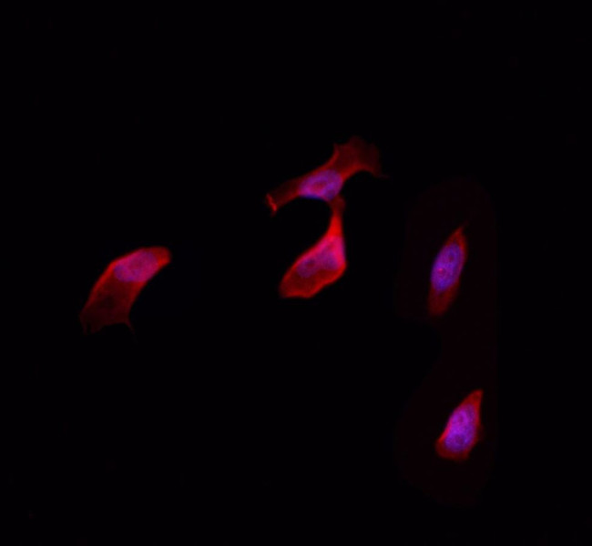 C/EBP delta/epsilon Antibody in Immunocytochemistry (ICC/IF)