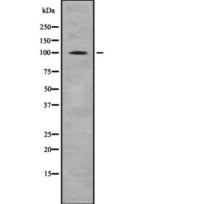 alpha E-Catenin/alpha N-Catenin Antibody in Western Blot (WB)