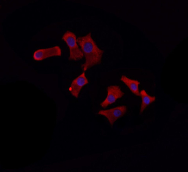 APC6 Antibody in Immunocytochemistry (ICC/IF)