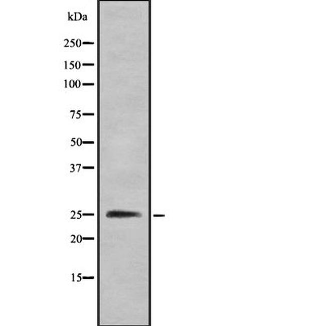 CMTM4 Antibody in Western Blot (WB)