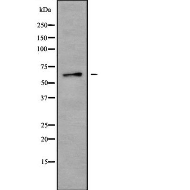 CPNE8 Antibody in Western Blot (WB)