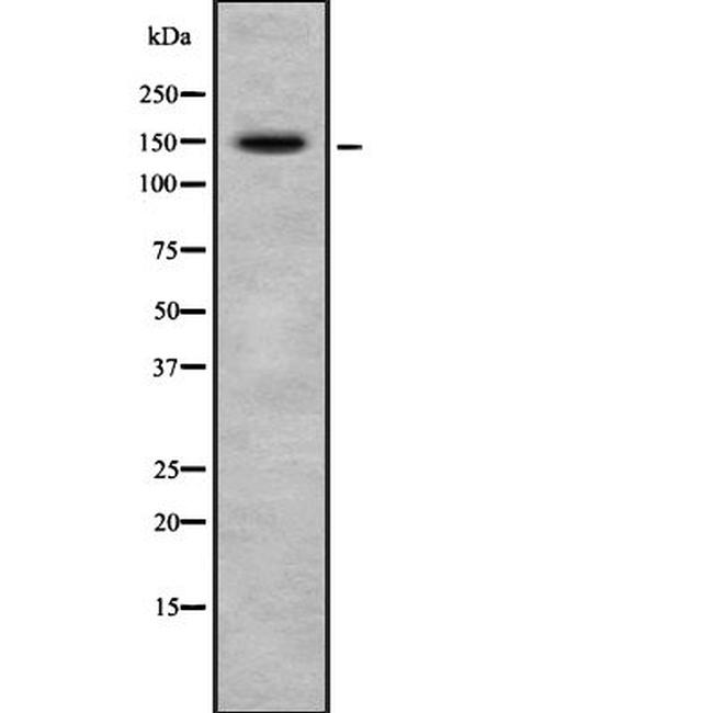 CRSP130 Antibody in Western Blot (WB)