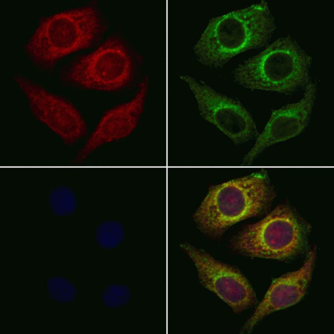 CYB561D1 Antibody in Immunocytochemistry (ICC/IF)