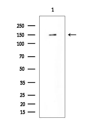 RBM6 Antibody in Western Blot (WB)