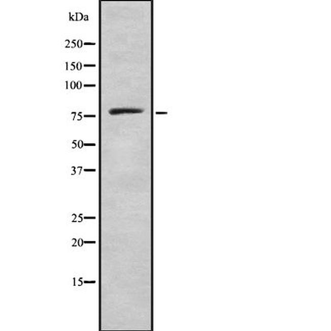 ELTD1 Antibody in Western Blot (WB)