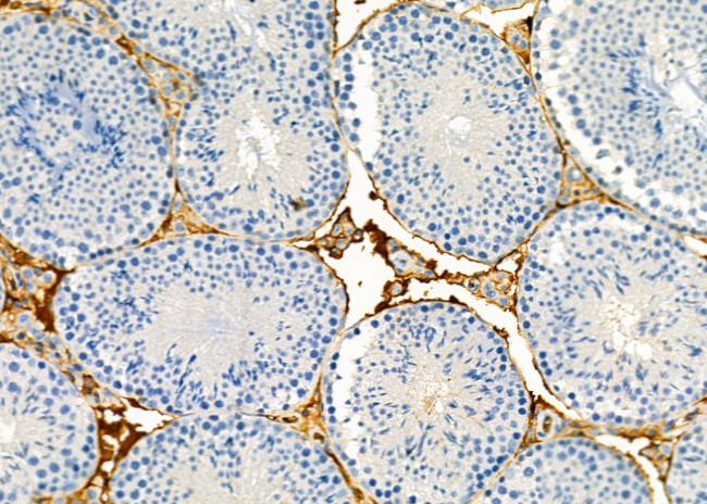 FGF22 Antibody in Immunohistochemistry (Paraffin) (IHC (P))