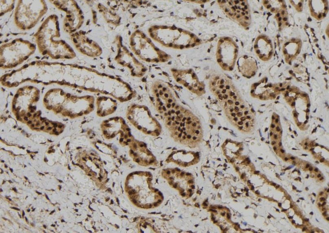 FOXR1 Antibody in Immunohistochemistry (Paraffin) (IHC (P))
