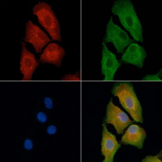 PMP22 Antibody in Immunocytochemistry (ICC/IF)
