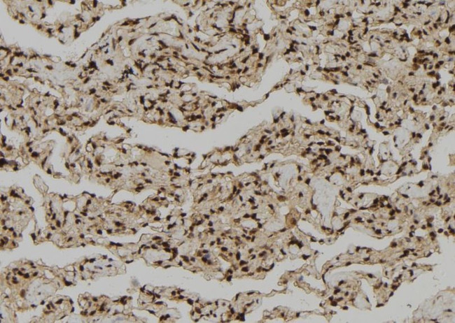 Granzyme H Antibody in Immunohistochemistry (Paraffin) (IHC (P))