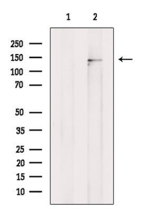 KCNT1 Antibody in Western Blot (WB)