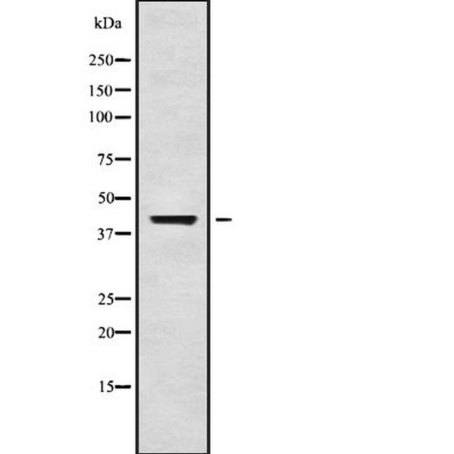 Kir3.1 (KCNJ3) Antibody in Western Blot (WB)