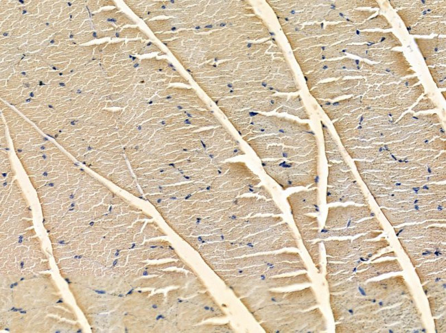 Kir3.4 (KCNJ5) Antibody in Immunohistochemistry (Paraffin) (IHC (P))