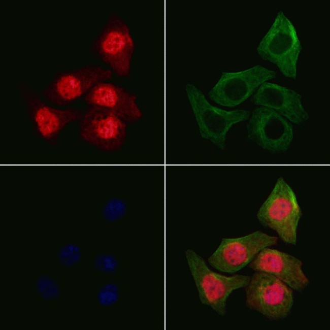 MPHOSPH1 Antibody in Immunocytochemistry (ICC/IF)