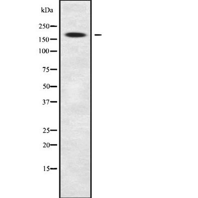 MRCK beta Antibody in Western Blot (WB)
