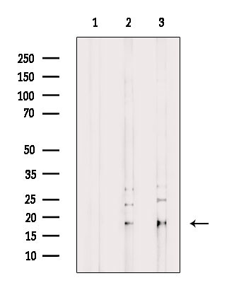 MYL9/MRLC2 Antibody in Western Blot (WB)