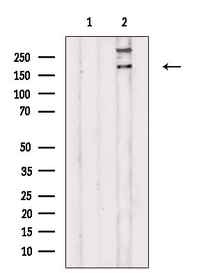SCN7A Antibody in Western Blot (WB)