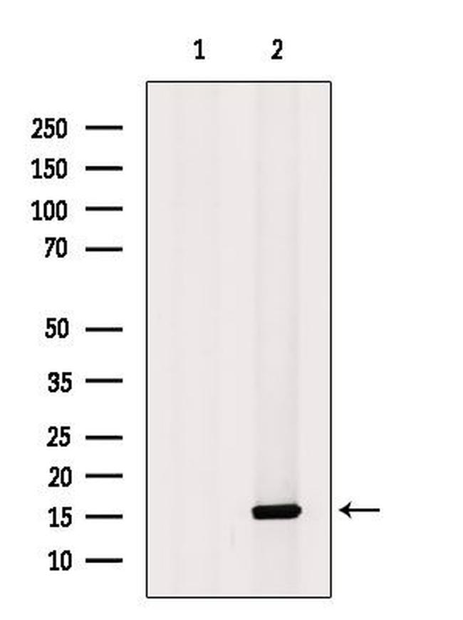NDUFS5 Antibody in Western Blot (WB)