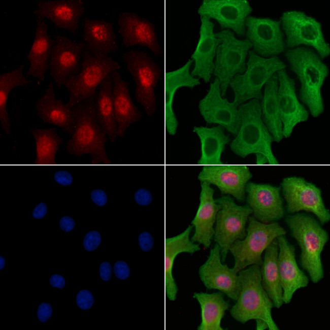 NIPA Antibody in Immunocytochemistry (ICC/IF)