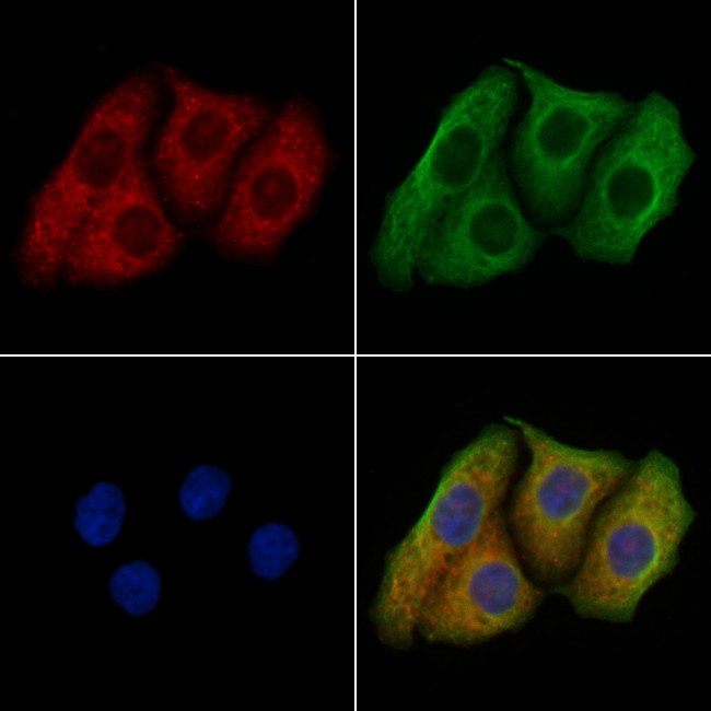 PXMP4 Antibody in Immunocytochemistry (ICC/IF)