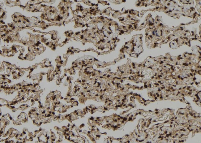 PSKH1 Antibody in Immunohistochemistry (Paraffin) (IHC (P))