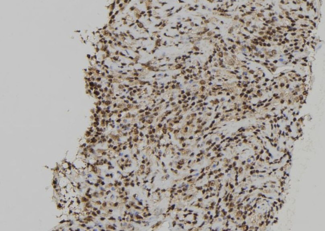 RCC2 Antibody in Immunohistochemistry (Paraffin) (IHC (P))