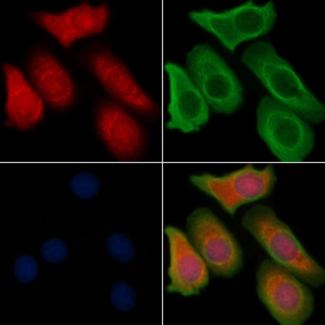 RhoBTB3 Antibody in Immunocytochemistry (ICC/IF)