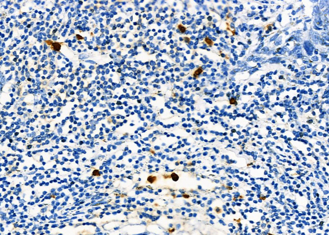 SIN3B Antibody in Immunohistochemistry (Paraffin) (IHC (P))