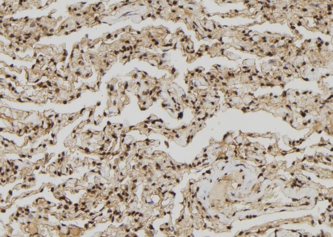 ZNF280A Antibody in Immunohistochemistry (Paraffin) (IHC (P))