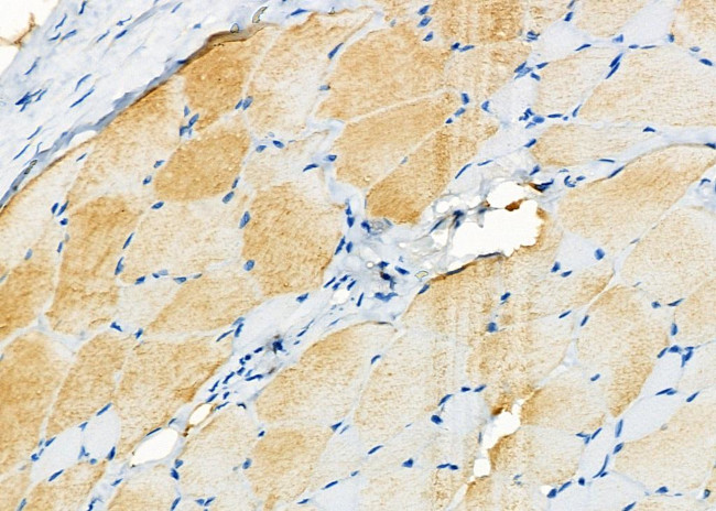 TAUT Antibody in Immunohistochemistry (Paraffin) (IHC (P))