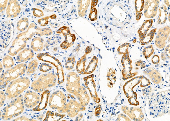 TBL2 Antibody in Immunohistochemistry (Paraffin) (IHC (P))