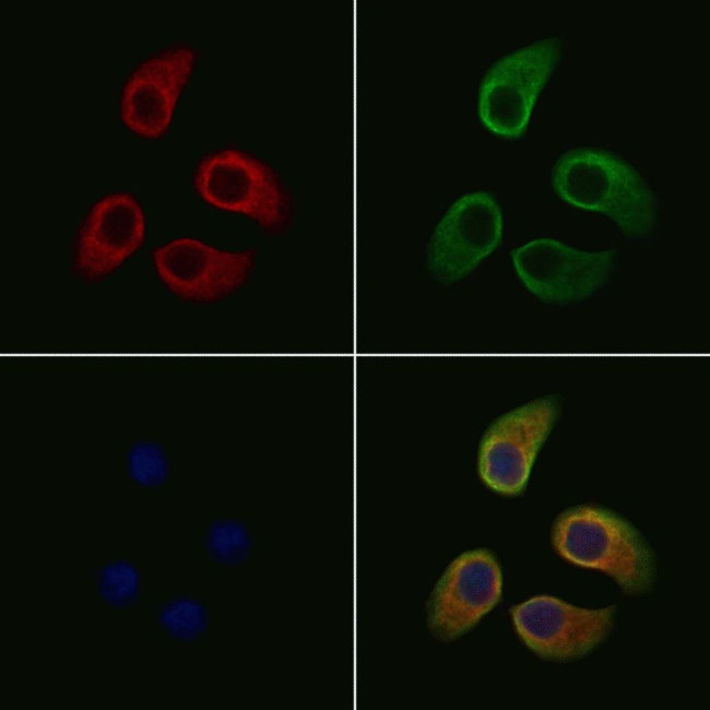 SLC39A2 Antibody in Immunocytochemistry (ICC/IF)