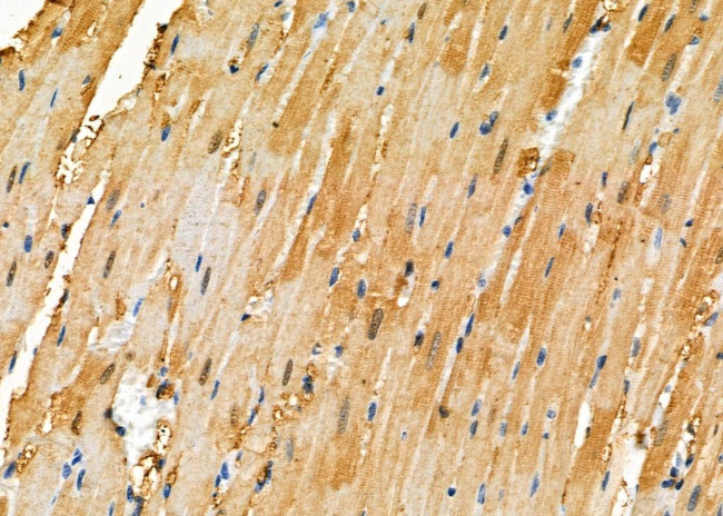 ZMYM4 Antibody in Immunohistochemistry (Paraffin) (IHC (P))