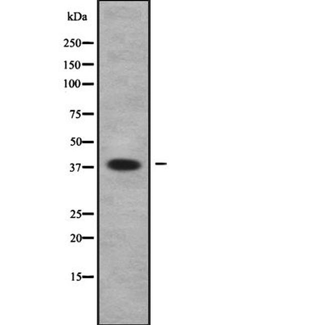 UBE2U Antibody in Western Blot (WB)