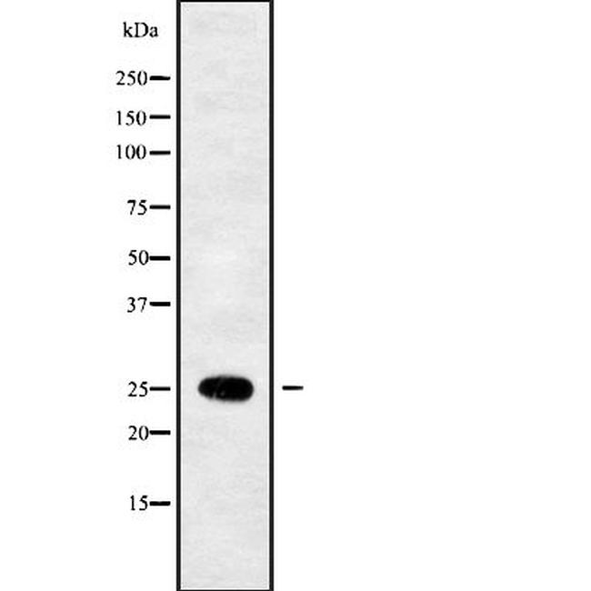 SEC22B Antibody in Western Blot (WB)