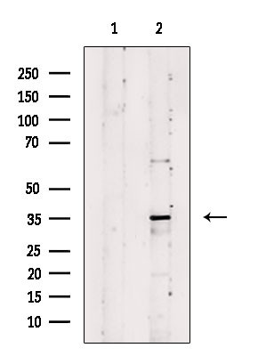 MAGEA6 Antibody in Western Blot (WB)