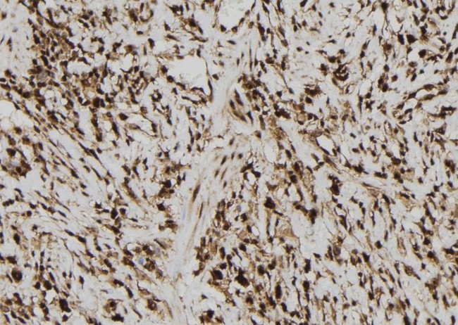 MAGEB10 Antibody in Immunohistochemistry (Paraffin) (IHC (P))